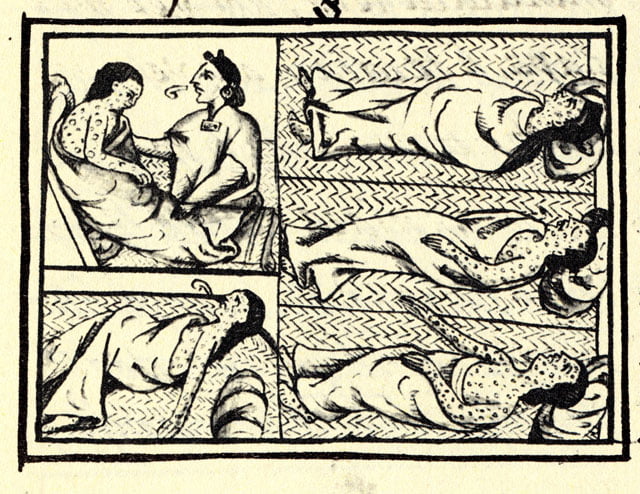 FlorentineCodex_BK12_F54_smallpox