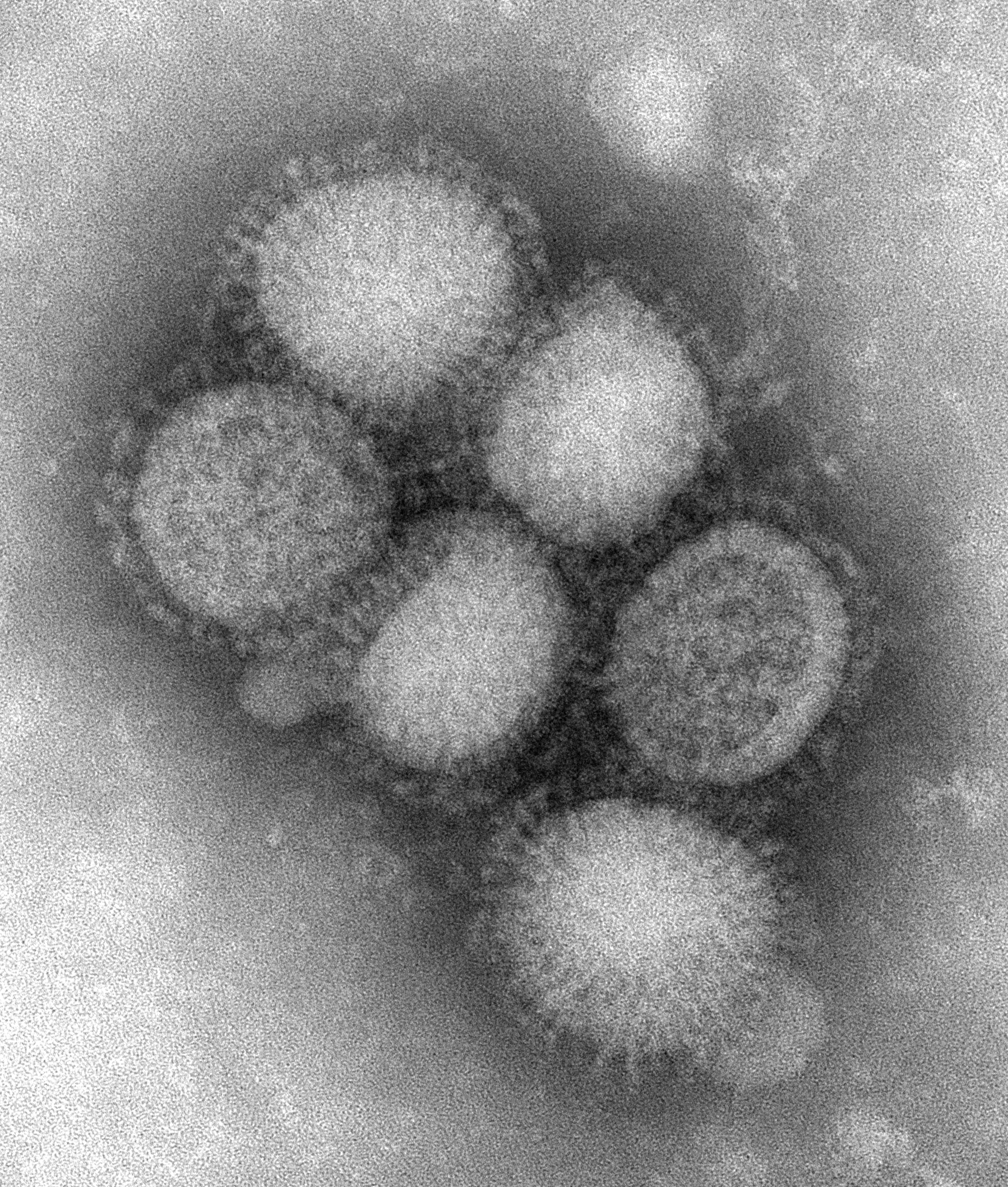 03. Imagen de microscopía electrónica del virus H1N1.